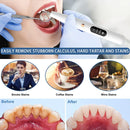 Ultrasonic Dental Calculus Scaler for Teeth Electric Tartar Calculus Remover Plaque Stains Remover Dental Stone Removal with Led