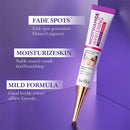 1/3pcs Nicotinamide Whitening Freckles Cream Remove Melasma Dark Spot Acne Marks Brightening Skin Tone Face Skin Care