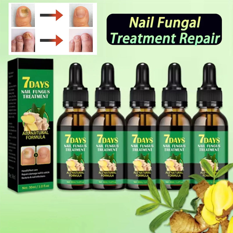 1-5Pcs Nail Fungal Treatment Device 7 Days Repair Oil Foot Toe Essence Anti Infection Paronychia Ginger Onychomycosis Gel Care