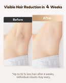 Professional IPL Hair Removal Laser 999900 Flashes Painless Pulsed Light Epilator HR/RA/SC 3 in 1 Whole Body Treament Home Use