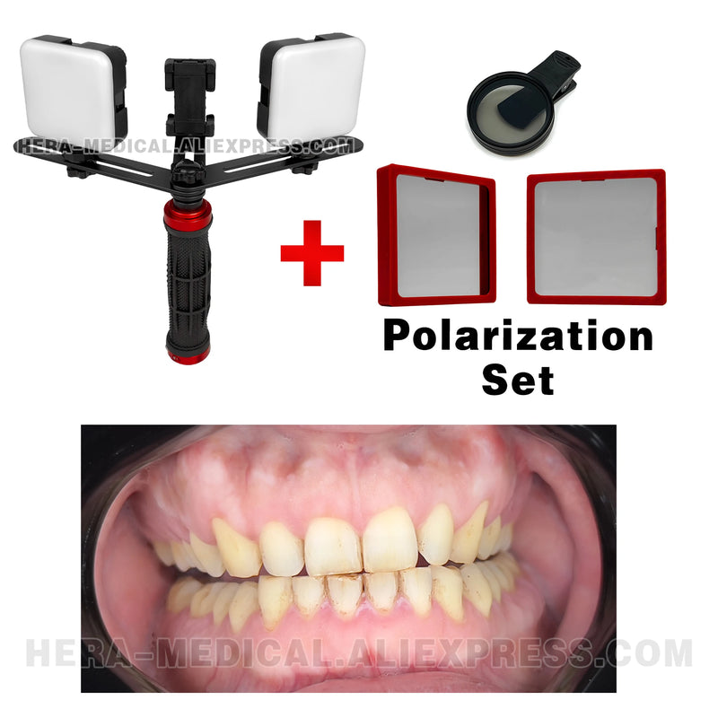 Dental Photography LED Light Bluetooth Intraoral Photo Lighting For Dentist Treatment Lamp Equipment For Dentist. MK-004