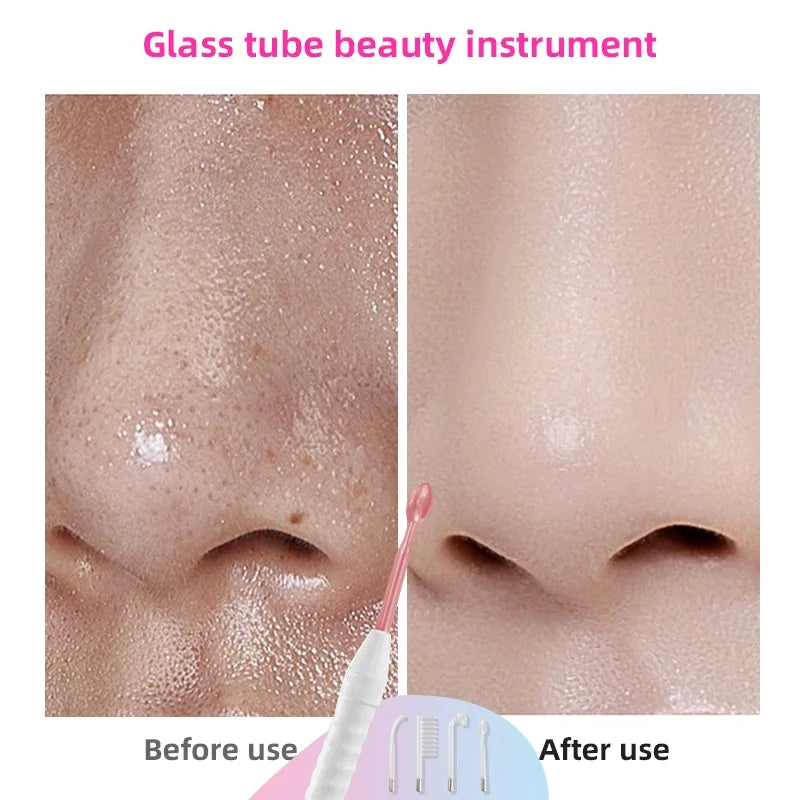 4-in-1 High-frequency Electrotherapy Glass Tube for Acne Removal and Spot Refinement Skin Hydrotherapy Facial Treatment Device