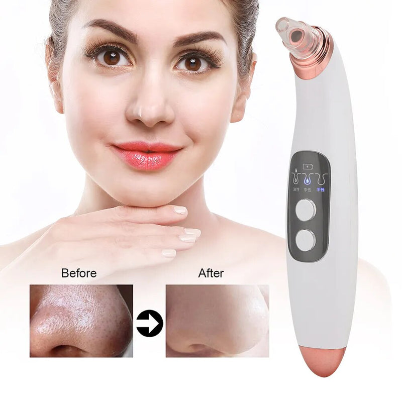 Facial Blackhead Remover Electric Acne Black Spots Pore Cleaner 3 Levels Adjustable Vacuum Suction Device with 4 Suction Heads