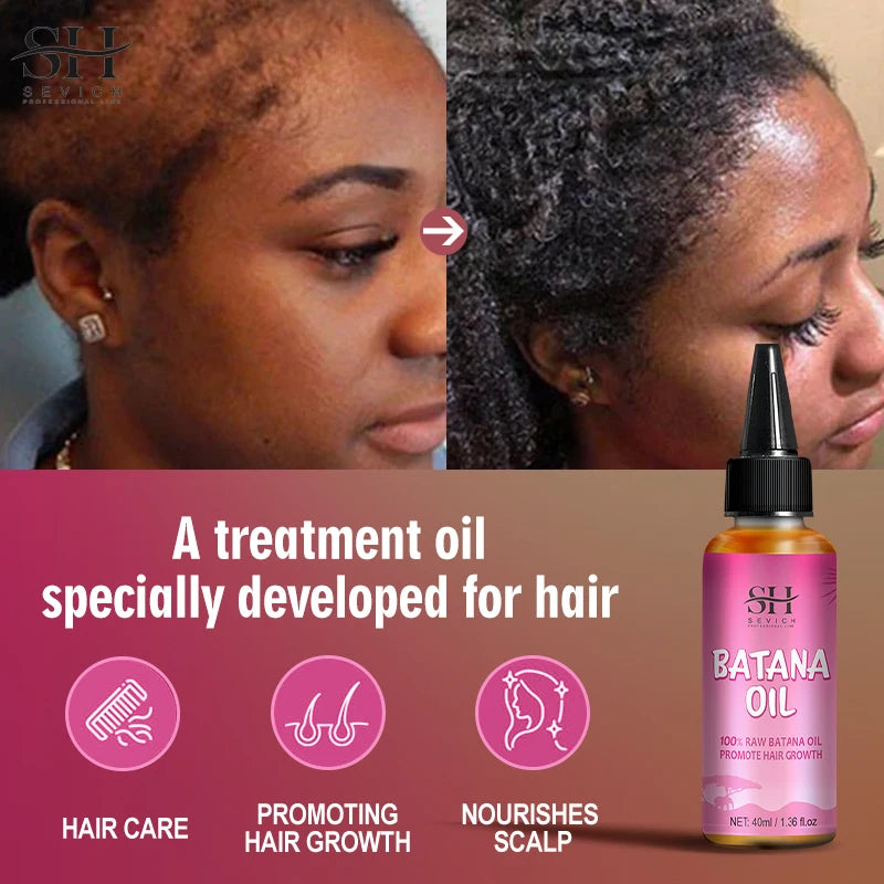 100% Batana Hair Fast Growth Oil Set African Crazy Traction Alopecia Batana Hair Mask Anti Hair Break Hair Regrowth Treatment