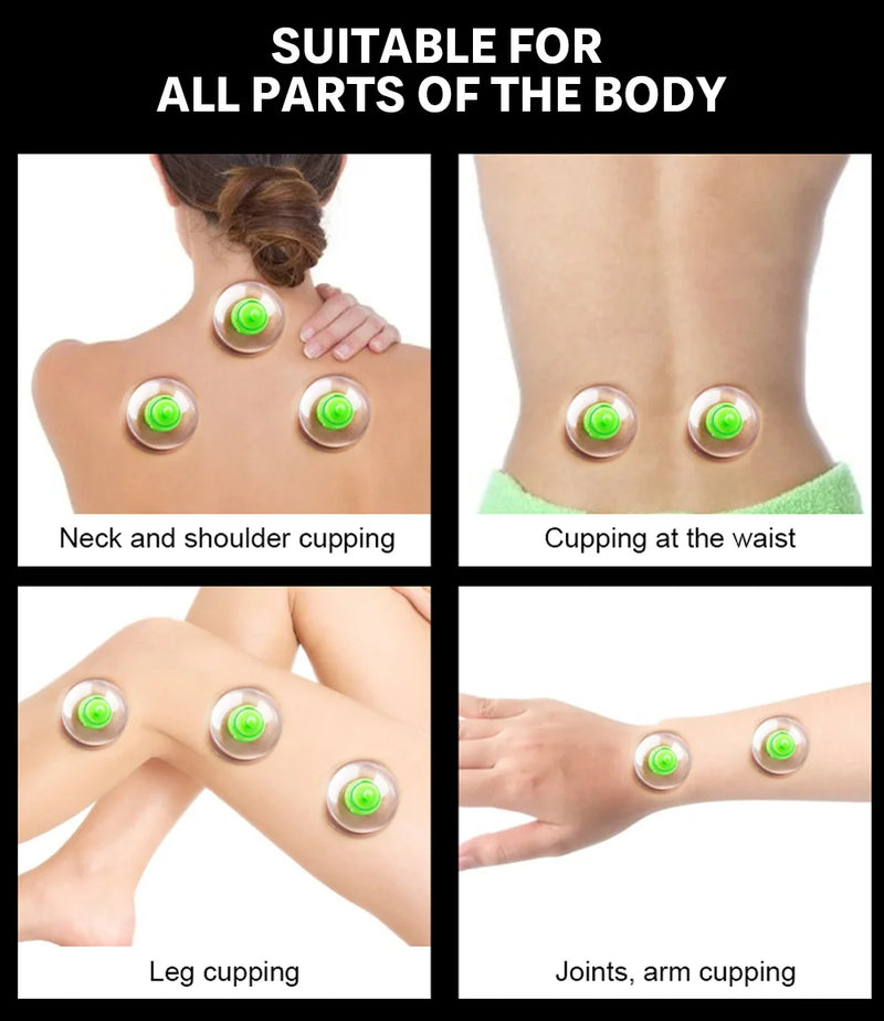 12/6Pcs Vacuum Cupping Sets Suction Cups Back Massage Body Cup Detox Massage Body Cups Ventosas Vacuum Cupping Massage Jars