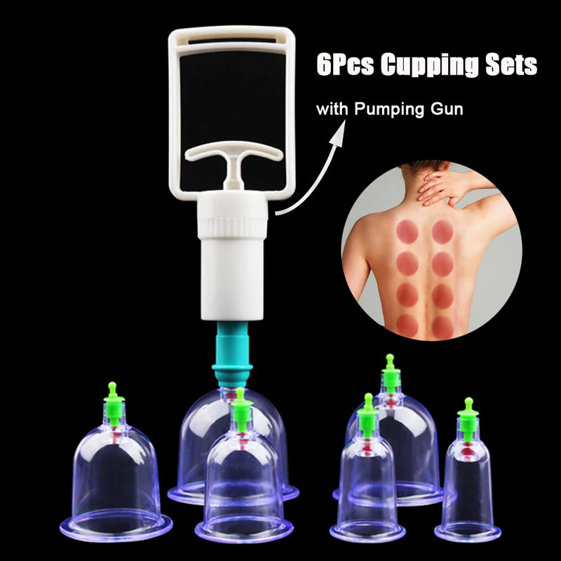 12/6Pcs Vacuum Cupping Sets Suction Cups Back Massage Body Cup Detox Massage Body Cups Ventosas Vacuum Cupping Massage Jars