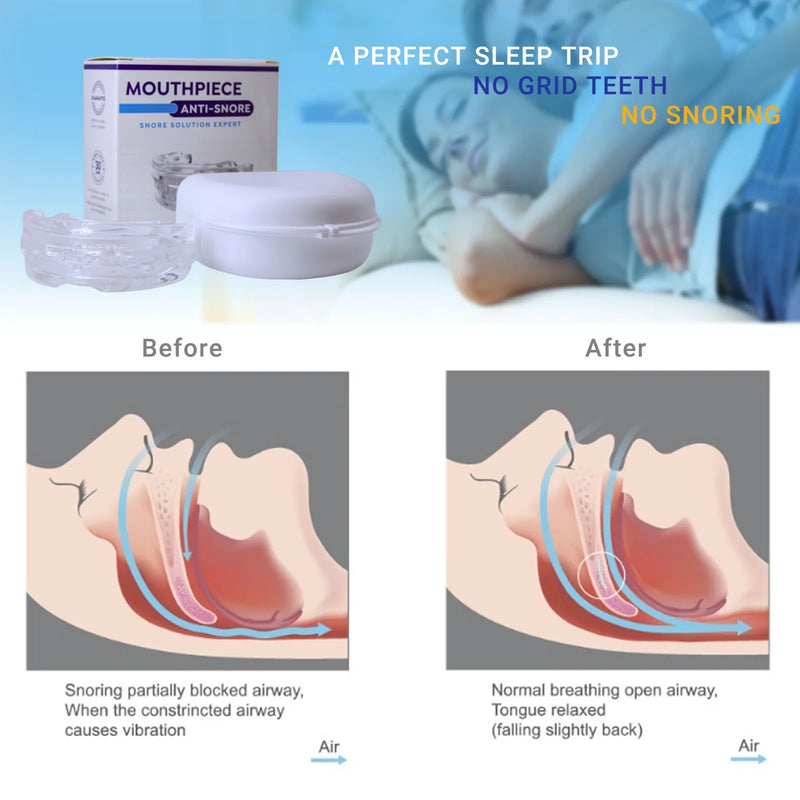 Adjustable Silicone Anti Snoring Device Teeth Whitening Night Sleep time Anti Grinding Braces