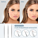 Beauty Salon Special Remove Acne Fat Particle Needle Tool Ultra-fine Cell Pimple Blackhead Whitehead Clip Black Dot Pore Cleaner