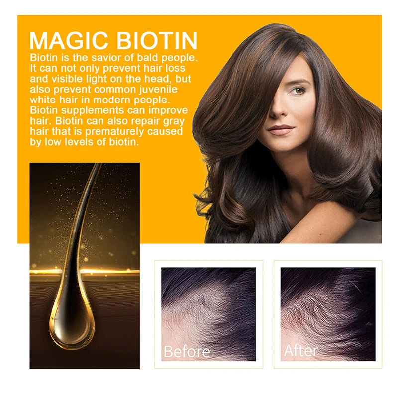 Biotin Fast Hair Growth Shampoo  Anti Hair Loss Serum Scalp Treatment Prevent Alopecia Baldness Conditioner Hair Care Hair Mask