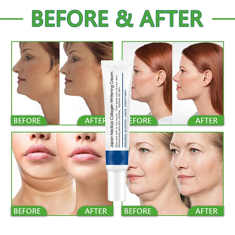 Collagen Neck Cream Anti-aging Tightens Lifts The Neck Chin Efficient Reducing Fine Lines In Skincare Brightening Moisturizing