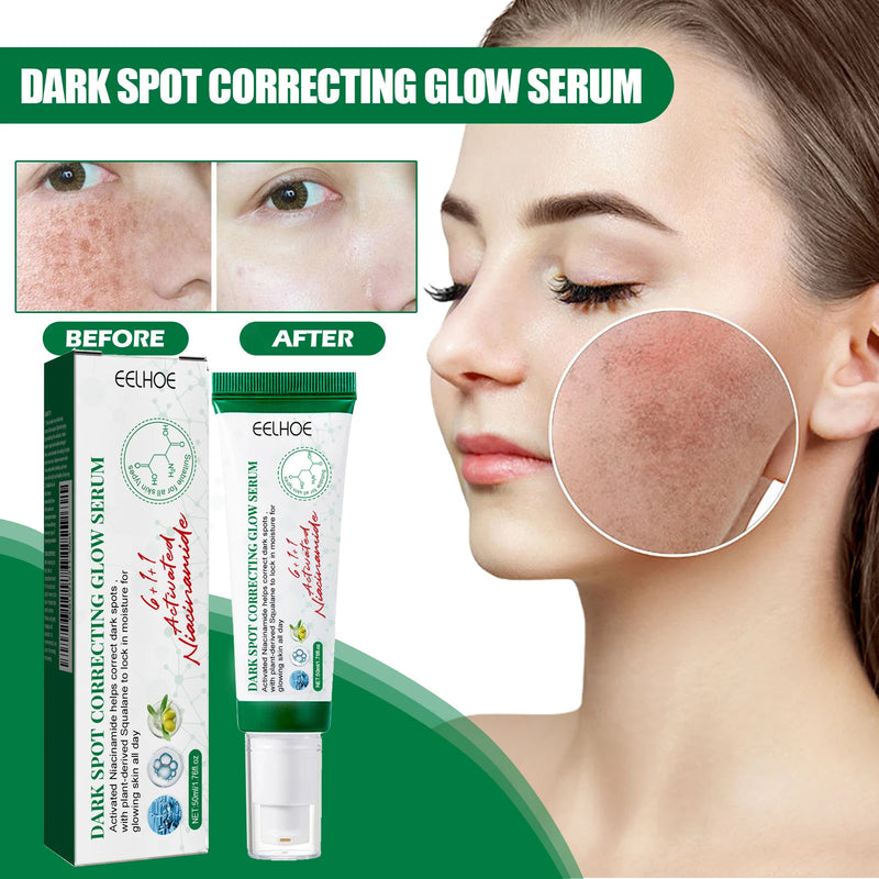 Dark Spot Correcting Glow Serum Fade Pigment Freckle Melasma Melanin Improves Dull Skin Facial Whitening Brightening Essence