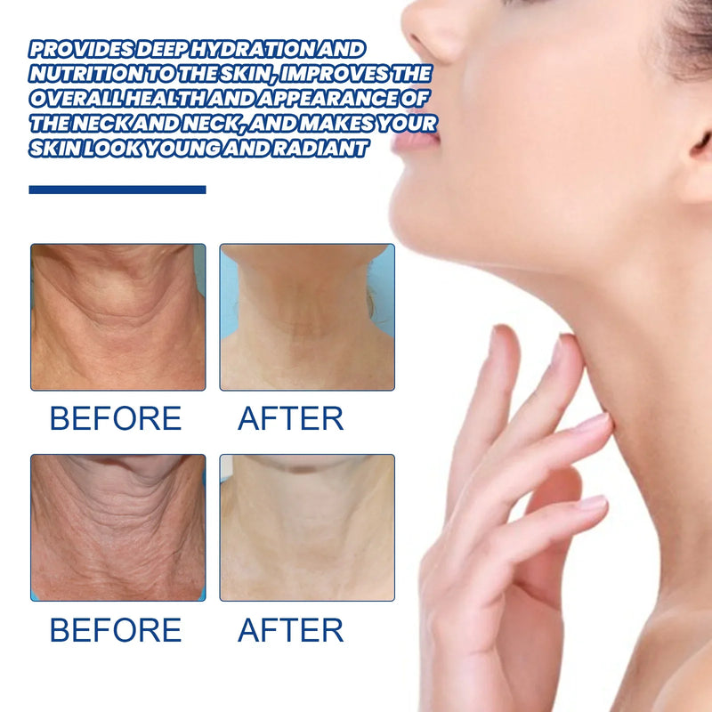 Collagen Neck Cream Anti-aging Whitening Moisturizing Tightening Lifting for Neck Double Chin Reducer Fine Lines Skin Care