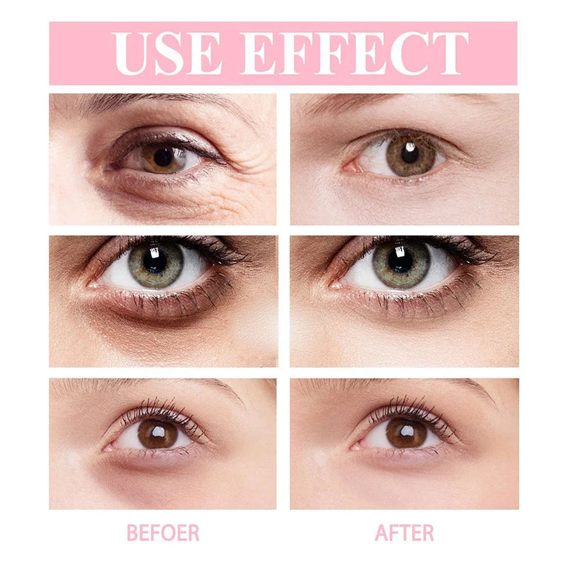Nti-Wrinkle Eye Cream Wrinkle Removing Dark Circles Lightening Fine Lines Moisturizing Whitening Skin Care Remove Eye Bag Stick