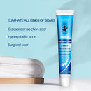 Sumifun 20 g Creme zur Entfernung von Aknenarben, Reparatur alter Narben, Reparatur, Verbrennungen, Glättung, Körper, Gesicht, feuchtigkeitsspendende Haut, Kräutercreme