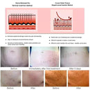 Bajonettanschluss Kartuschen Nadeln sterilisiert 1R 3R Permanent Make-up Maschinennadeln für PMU Tattoo Eyebrow Liner Lips Supplies