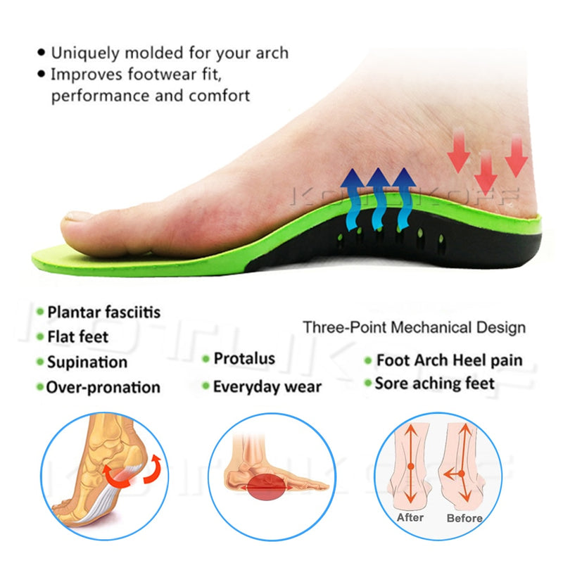 Beste Orthopädische Schuhe Sohleneinlagen für Schuhe Arch Foot Pad X / O Type Leg Correction Flat Foot Arch Support Sportschuhe Inserts