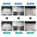 Ilisya Stirnfurchen-Patch Anti-Falten-Linien-Entfernungs-Aufkleber Zornesfalten-Hydrogele Anti-Aging-Feuchtigkeits-Patch Hautpflege