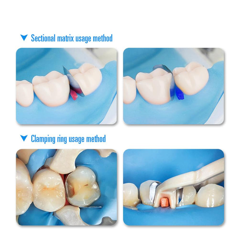 AZDENT Dental Schnittmatrizen Konturiertes System Metallmatrizen Zahnmatrizenband Harz Klemmtrennring Autoklavierbar