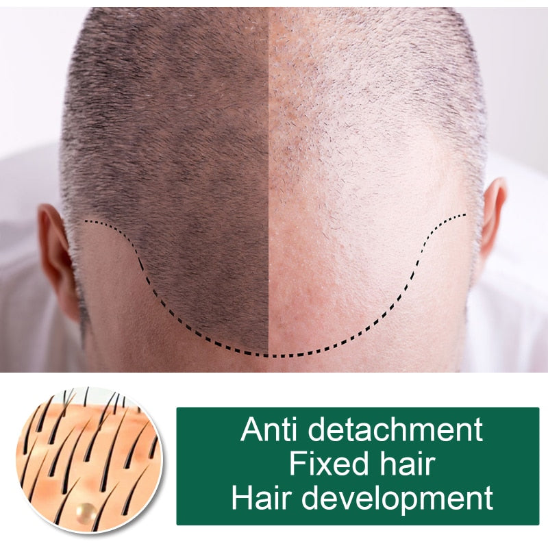 Spray de suero eficaz para el crecimiento del cabello, rápido y grueso para prevenir la pérdida de cabello, reparación de cabello dañado, productos naturales para el cuidado del cabello TSLM1