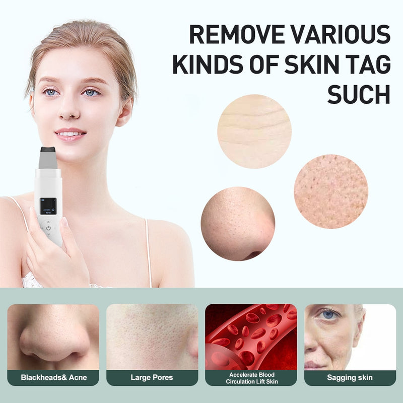 Ultraschall-Hautwäscher Ultraschall-Gesichtsreiniger Mitesser-Entferner Ultraschall-Peeling-Schaufel-Reiniger Gesichtsmassagegerät Hautpflege