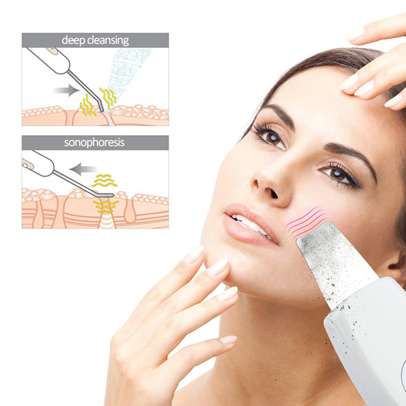 Beauty Star Ultraschall-Gesichtsreiniger Skin Scrubber Ultraschall-Vibrationsmassagegerät Ultraschall-Peeling Clean Tone Lift Scrubber