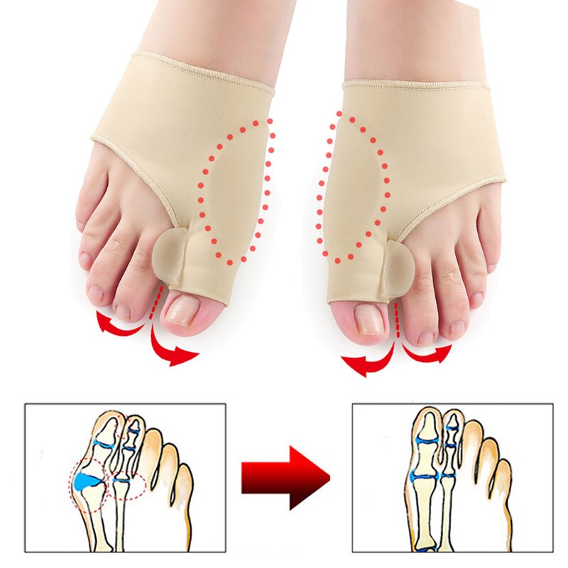 Toe Separator Bunion Corrector Orthopedic Pedicure Tool Stretcher Hallux Valgus Corrector Big Bone Thumb Adjuster Feet Care Tool