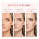 7 Farben LED Lichttherapie Gesichtsmaske Hautverjüngung Led Photon Gesichtsmaske Phototherapie Gesichtspflege Schönheit Anti Akne Maschine