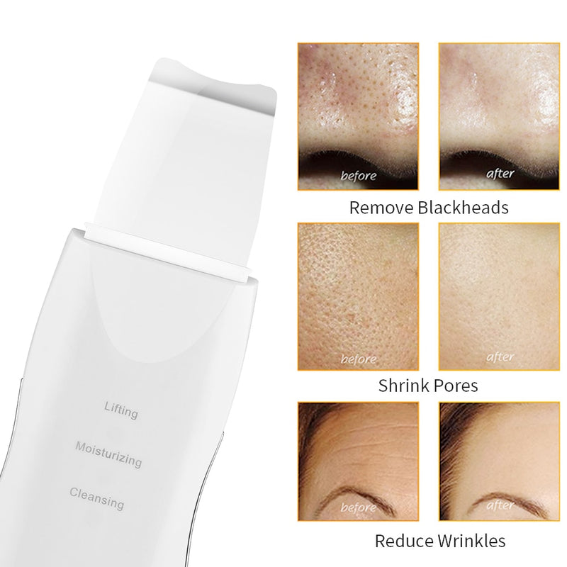 Ultrasonic Skin Scrubber Rechargeable Ion Deep Face Cleaning Vibration Massager Acne Blackhead Removal Cleanser Exfoliating Pore