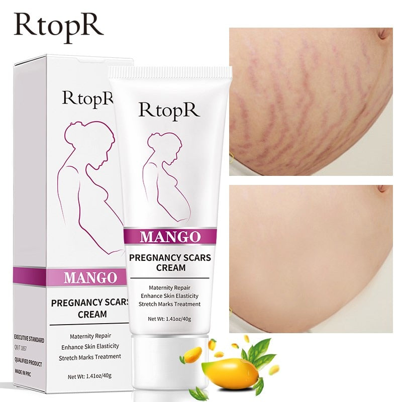 5pcs RtopR Mango Improves Skin Reduces Wrinkles Remove Skin Scars Treatments Pregnant Women Skin Cream Increases Skin Elasticity