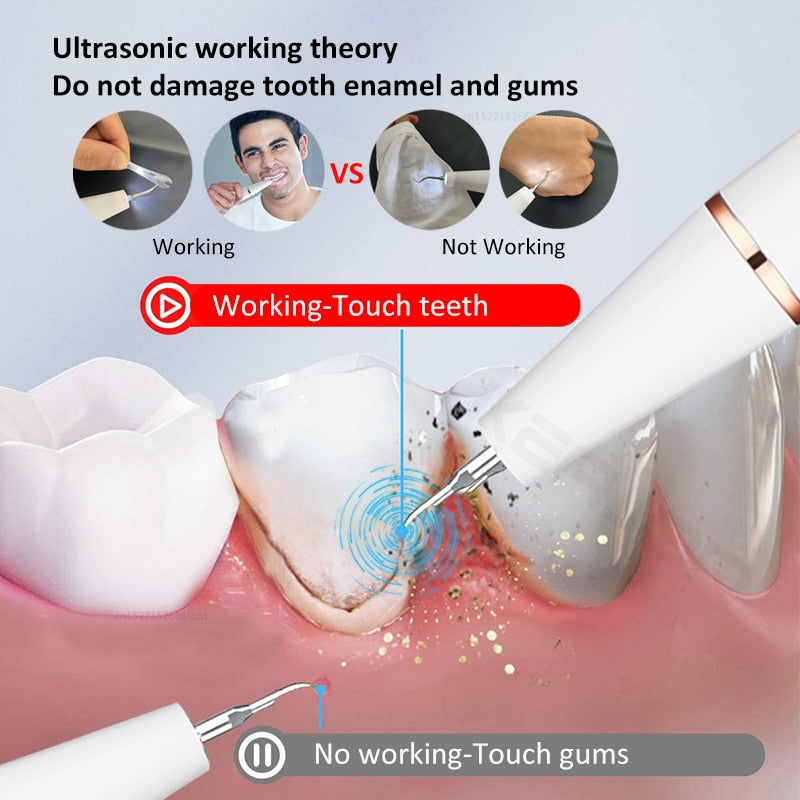 Elektrischer Sonic Dental Calculus Scaler Oral Teeth Tartar Remover Plaque Flecken Reiniger Entfernung Zahnaufhellung Tragbar mit LED