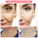 Elektroporation LED-Photonen-Gesichts-HF-Hochfrequenz-Hautverjüngung EMS-Mesotherapie für eine straffere Gesichtsstraffungs-Schönheitsbehandlung