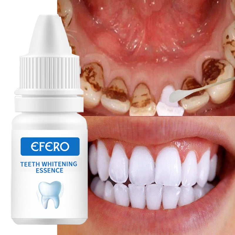 EFERO Teeth Whitening Essence Powder Clean Mundhygiene Zähne aufhellen Plaqueflecken entfernen Frischer Atem Mundhygiene Dental Tools