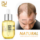 PURC Natural Hair Growth Essence Thickener Regrowth Serum Treatments Oil Fast Grow Hair for Hair Loss Care Products Men &amp; Women